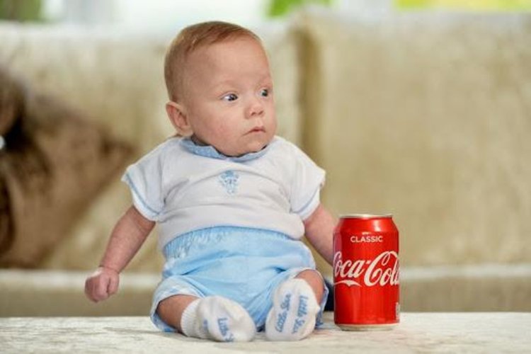 Бебче, родено 340 грама, оцеля!