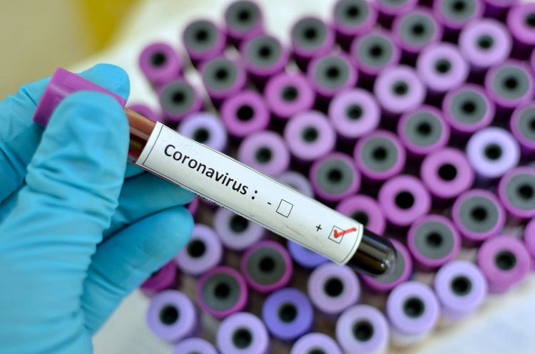713 са потвърдените случаи на COVID-19 у нас