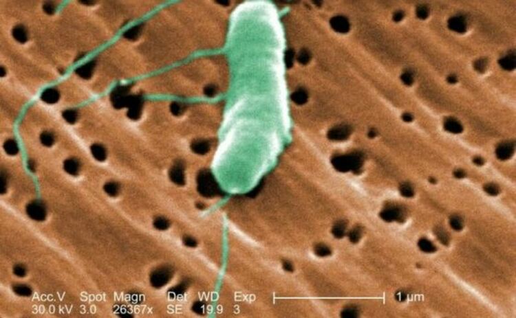 Всичко за „бактерията-човекоядец“ - Vibrio vulnificus, която наскоро едва не уби жена в Силистар